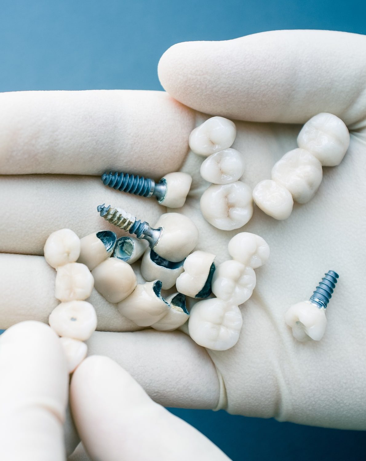 Dentist holding dental implants.